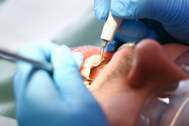 Best Walk-In Emergency Dental Services in Clarksdale, MS